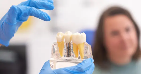 Healing Timeline for Dental Implants in Washington Healing Timeline for Dental Implants in Washington